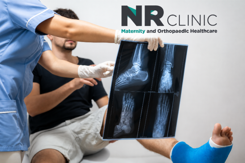Fracture Treatment in Ulsoor Types of Fractures and Recovery